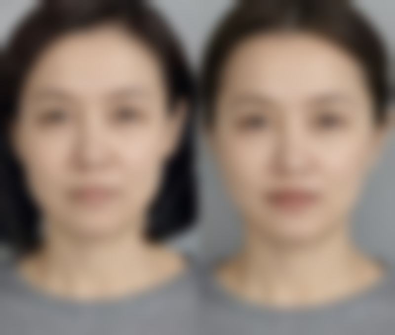 齐淑敏医生做手术价格