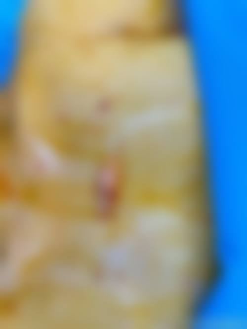 云浮市人民医院价格表