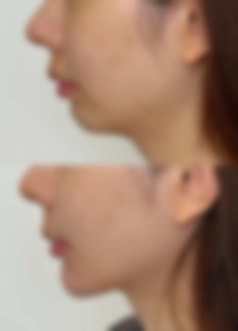 保定妍栢美容医院项目特色