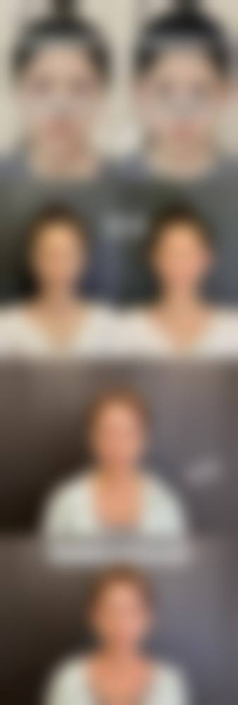 郑州第一人民医院整形外科价格表