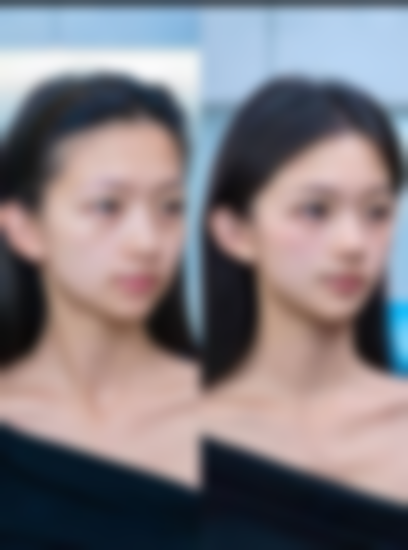 四、韩国Light整形外科怎么样，正规吗？