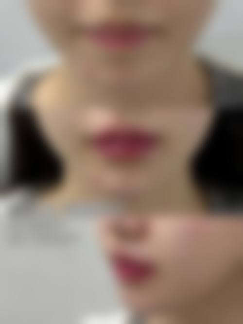 韩媄医疗美容门诊部怎么样?有哪些特色项目