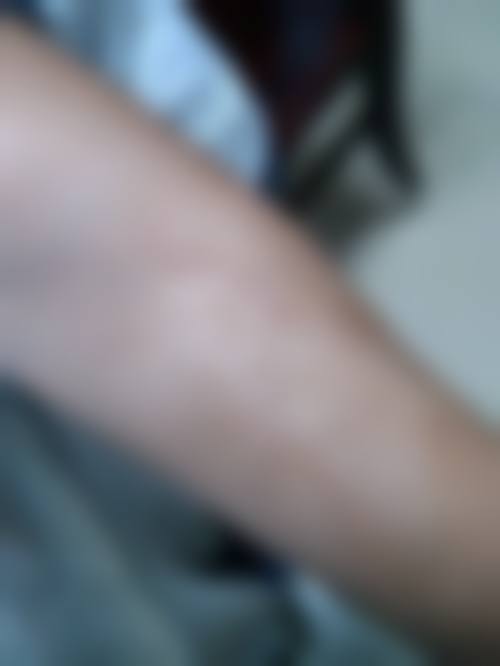 韩媄医疗美容门诊部怎么样?顾客实例