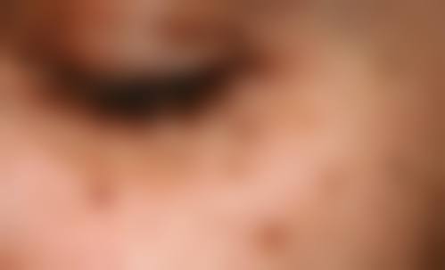 宁波唯爱医疗美容门诊部特色项目有哪些