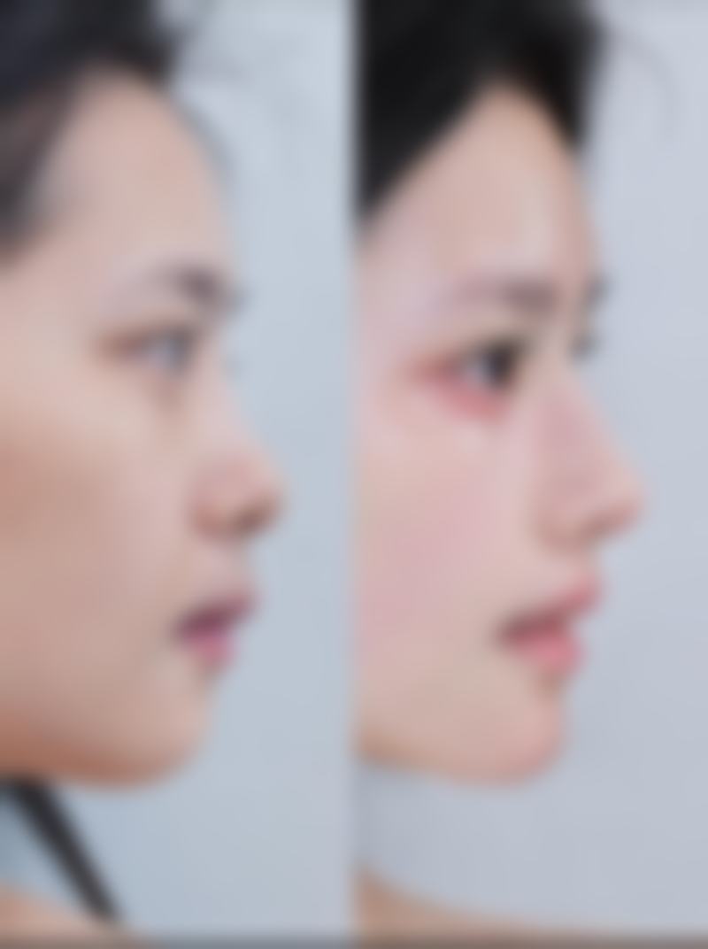 宁波唯爱医疗美容门诊部顾客实例