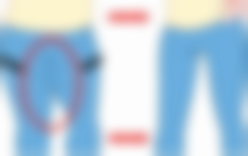 洪敏锡医生怎么挂号