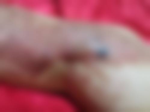 武汉星爱医疗美容门诊部顾客实例