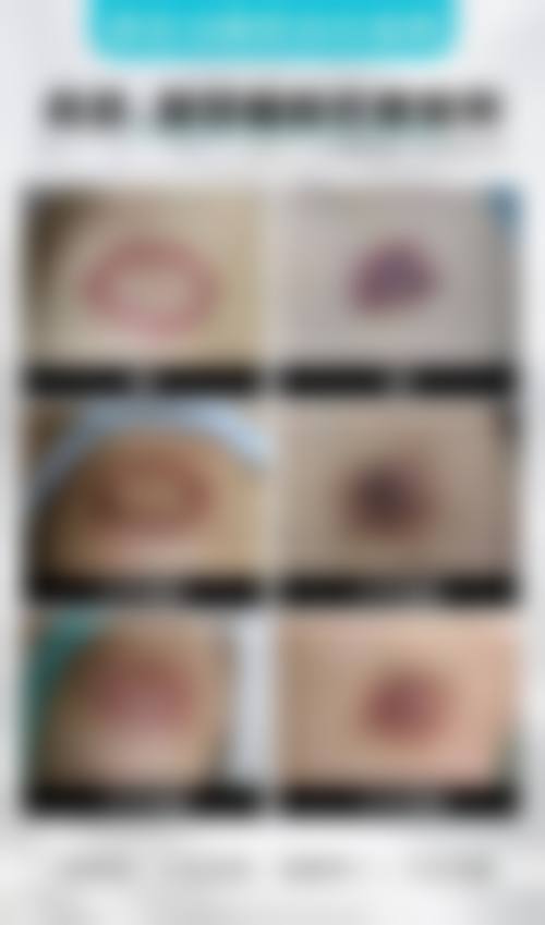 南昌马克整形医院怎么样价格表