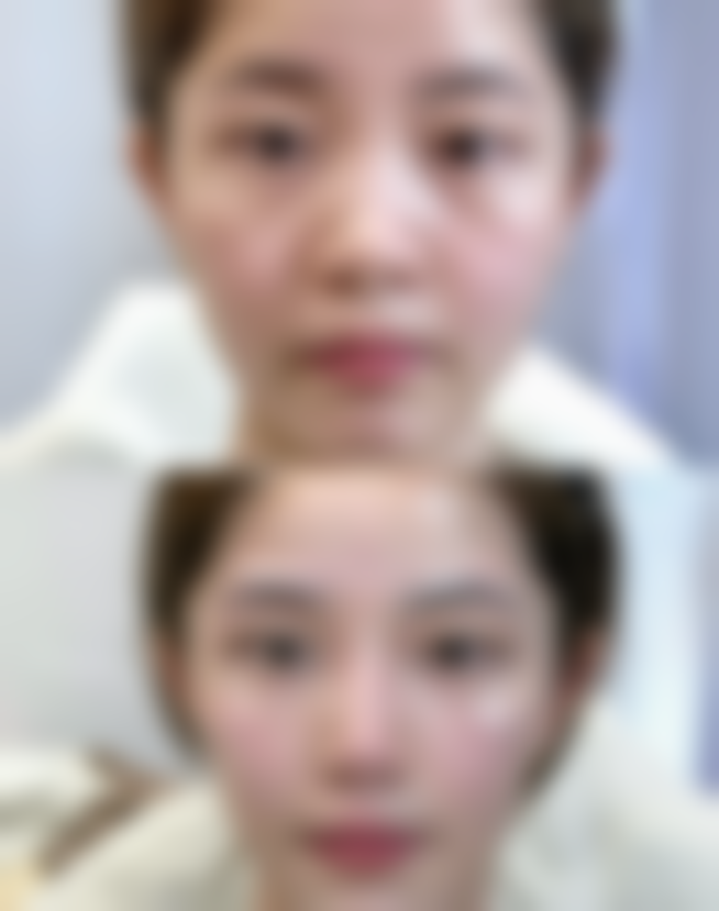 Regina Clinic京都河原町抖音团购活动有哪些,价格表