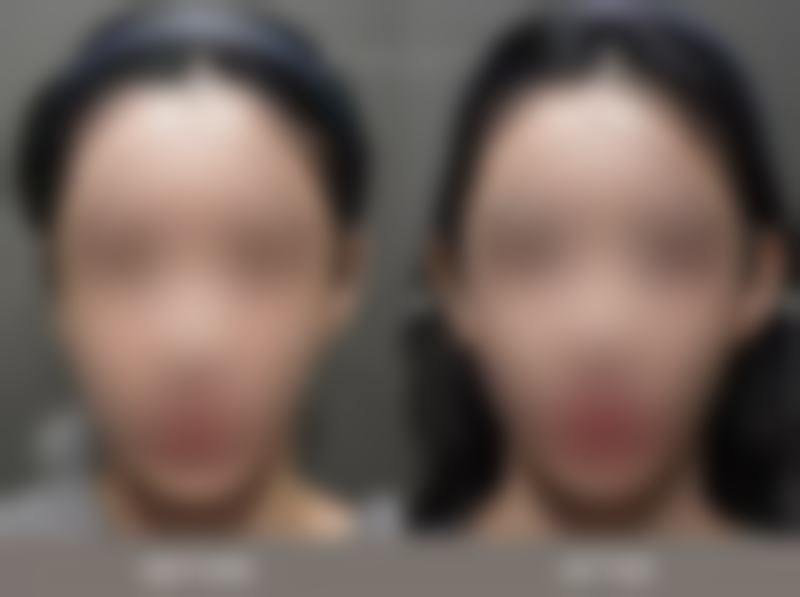 韩国开开整形外科的口碑好不好