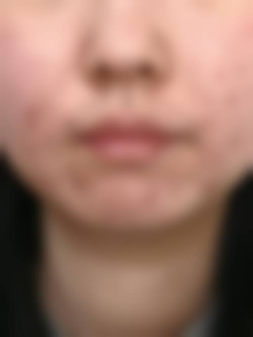 广州从化现代整形医院项目特色