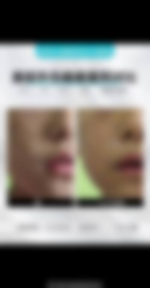 上海渡星整形医院怎么样——口碑好不好？附真实患者口碑评价