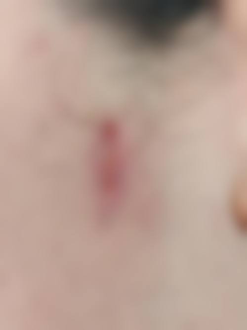 襄阳海峡整形医疗美容门诊部更擅长什么