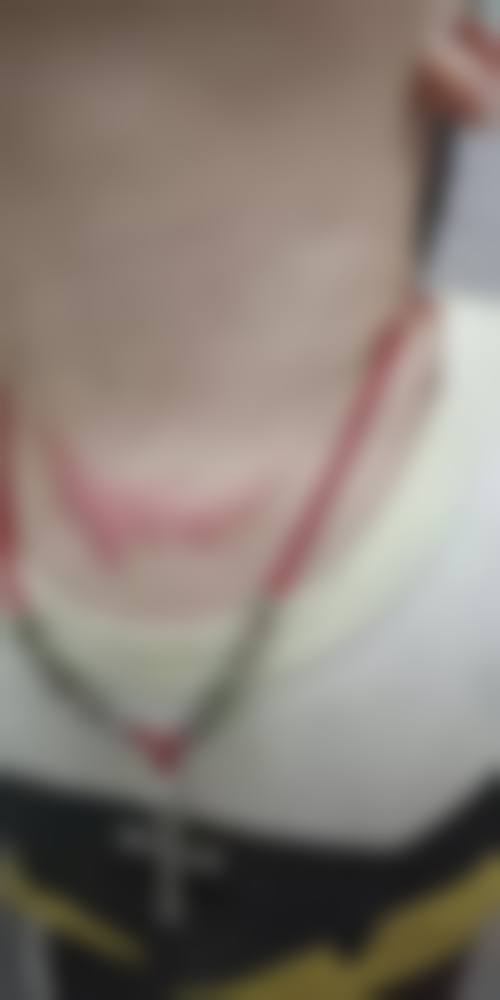 刘纯熙医生简介做手术价格