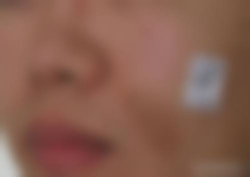 广州从化现代整形医院价格表