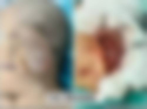 上海渡星整形医院怎么样——价格表