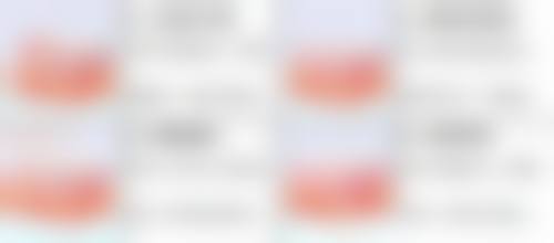 knockknockplant牙科抖音团购及价格表情况