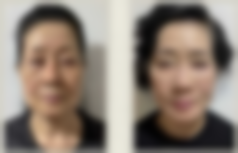 韩国清潭高云世上皮肤科医生情况