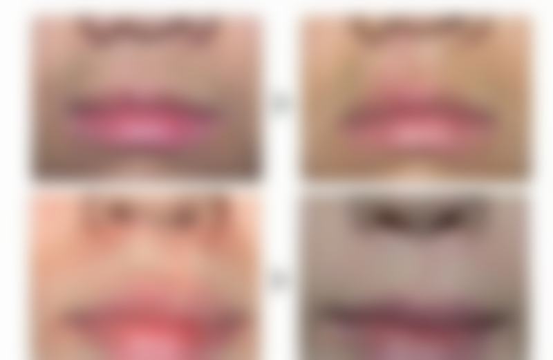 合肥咛萌肌因整形医院怎么样之口碑好不好？附真实患者口碑评价