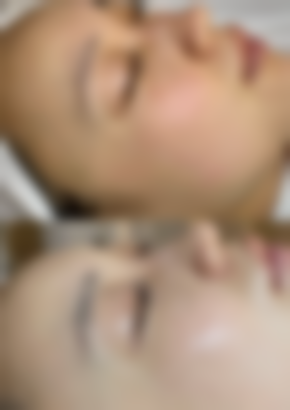 厦门思明普尔美至医疗美容诊所价格表