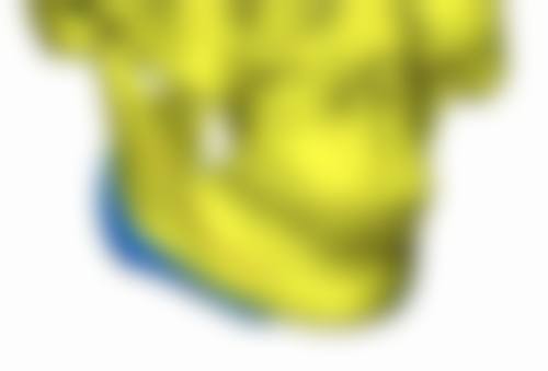 詹卫群医生简介口碑如何