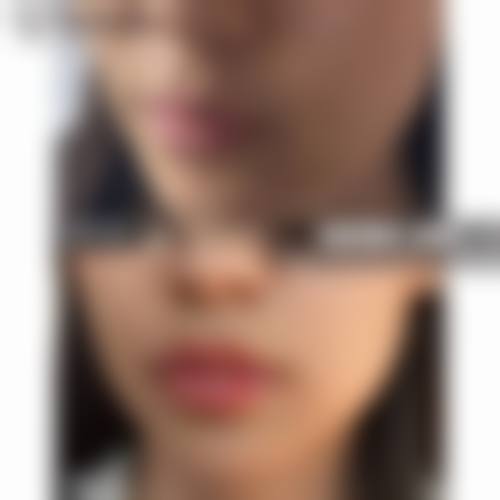 西安美丽妍妍整形医院怎么样，口碑评价如何？