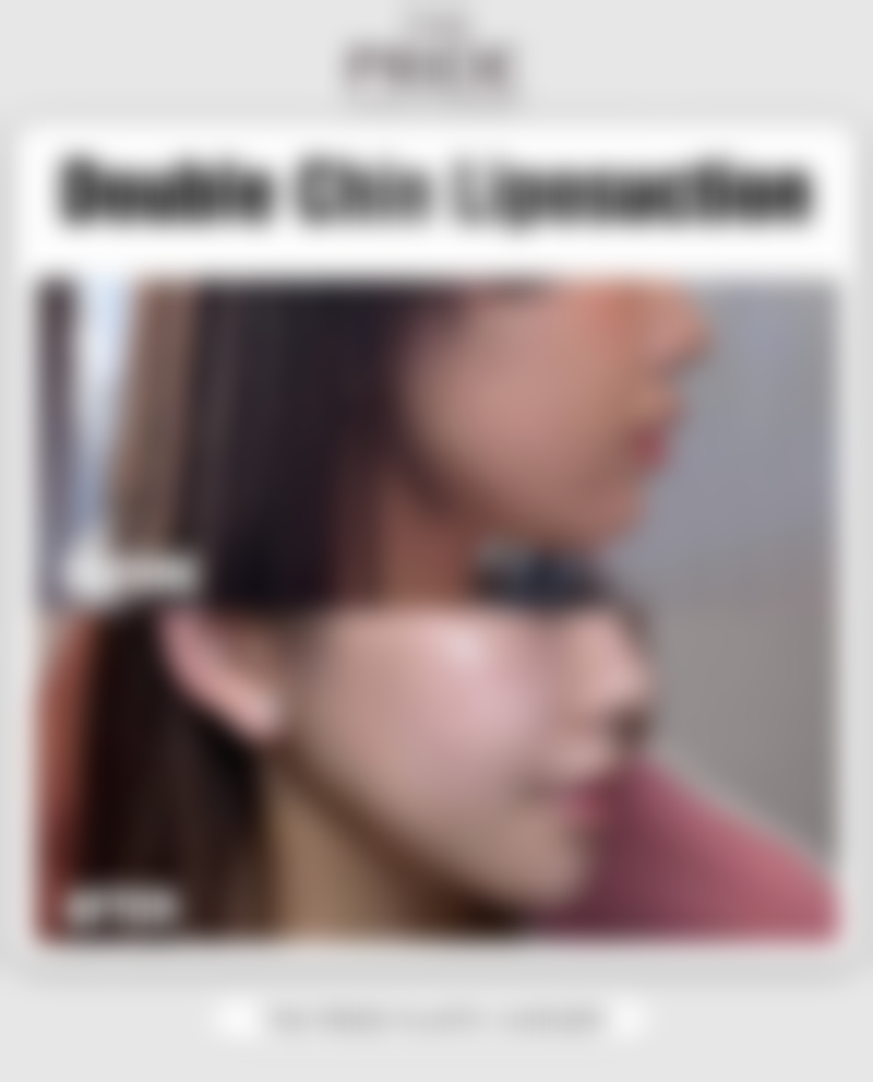 詹卫群医生简介做手术价格