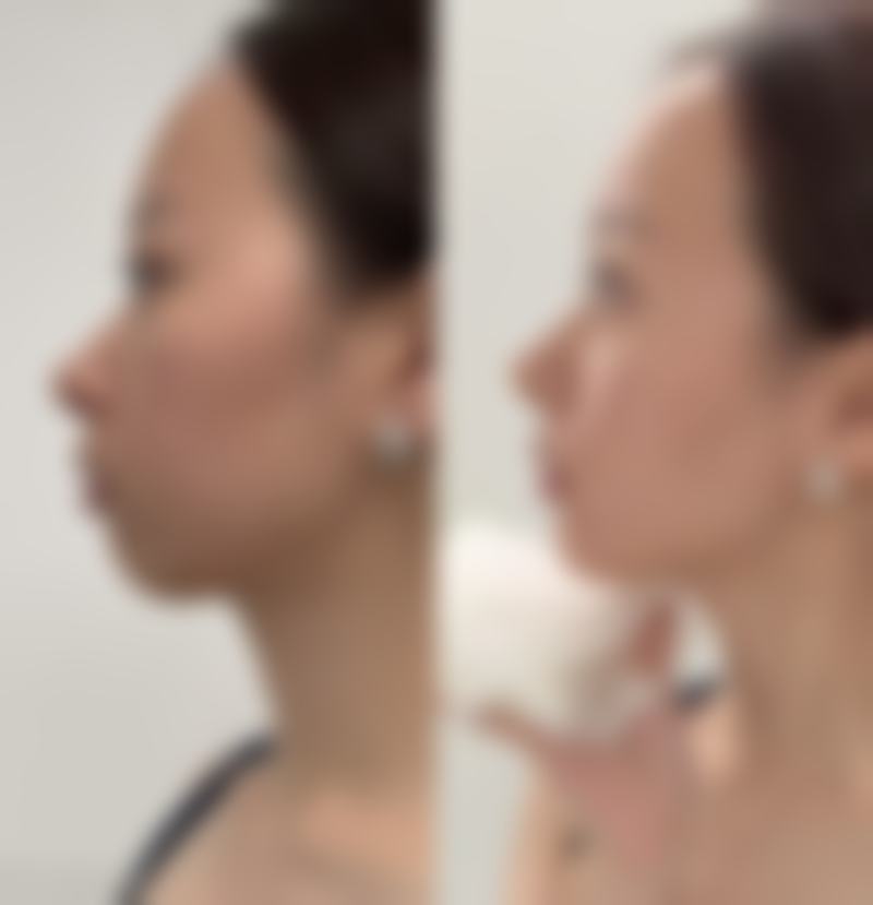 成都爵丽医疗美容医院口碑好不好？附真实患者口碑评价