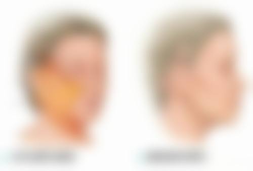 吴阳医生顾客实例