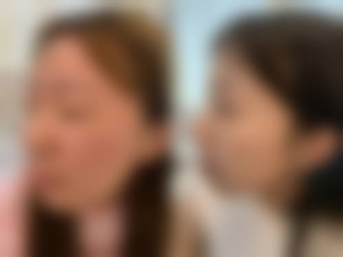 南京极妍整形医院怎么样之价格表