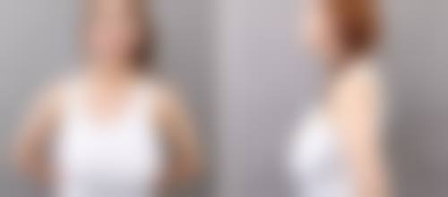 深圳爱上美医疗美容诊所评价