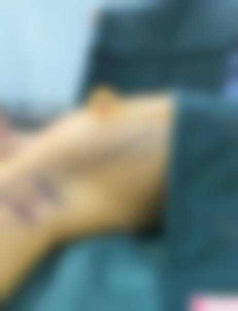 广州艾妃媄后医疗美容门诊部（原铂娅曼）价格表