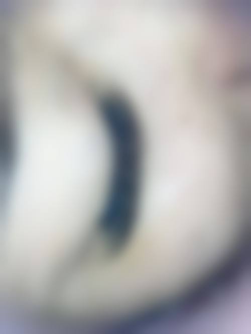 合肥大麦微针植发医院项目特色怎么样