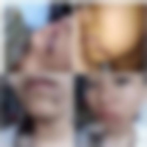 岳阳市中 心医院(烧伤整形美容科)地址及乘车路线