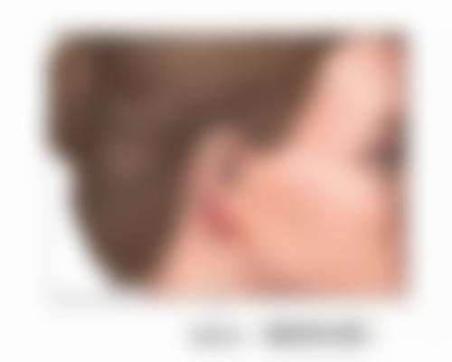 李玲医生做手术价格