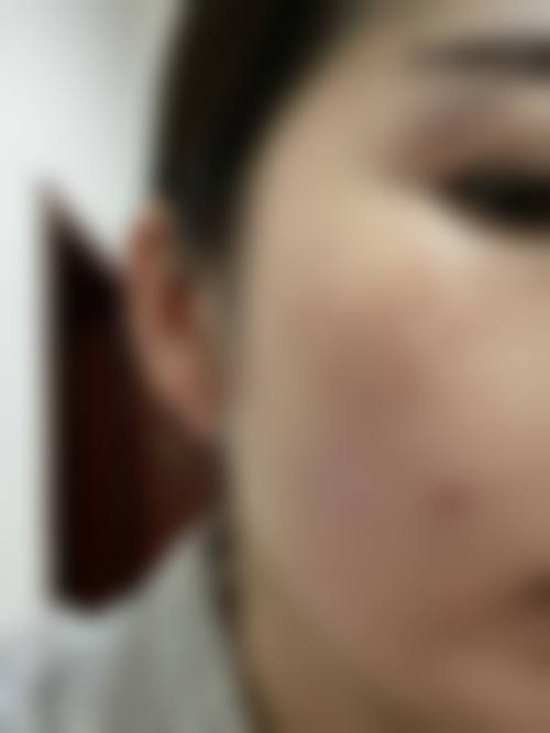 成都绮澳医疗美容诊所价格表