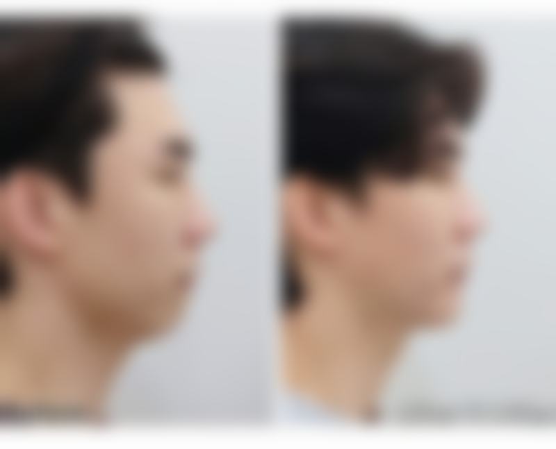 广州妃整形医院口碑评价