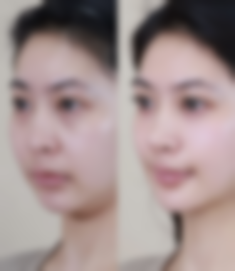 李玲医生项目优势