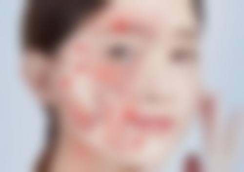 太原鑫晨聚美美容门诊部顾客实例