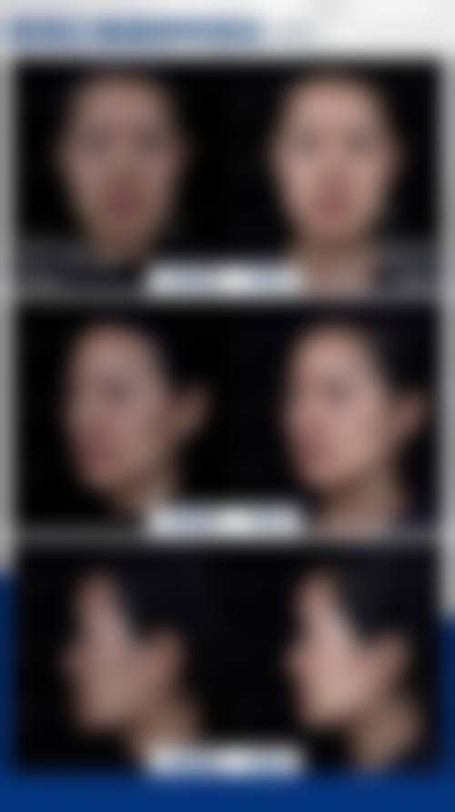 南宁密斯整形医疗美容诊所评价