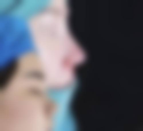 白城春俏美容整形医院怎么样之真实患者口碑评价