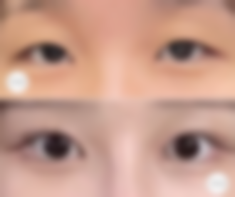 南宁脂美人整形美容医院地址及乘车路线