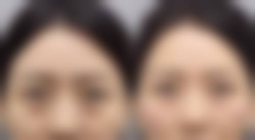 李顺善医生简介项目优势