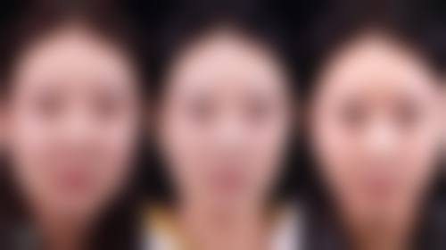 杨宏伟医生怎么挂号