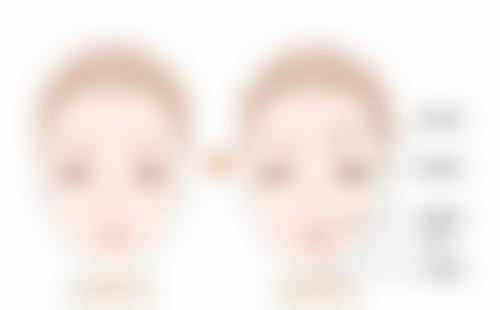 赵熙蕊医生简介做手术价格