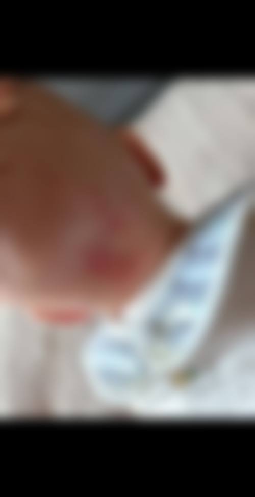 沧州刘羚医疗美容诊所可靠吗