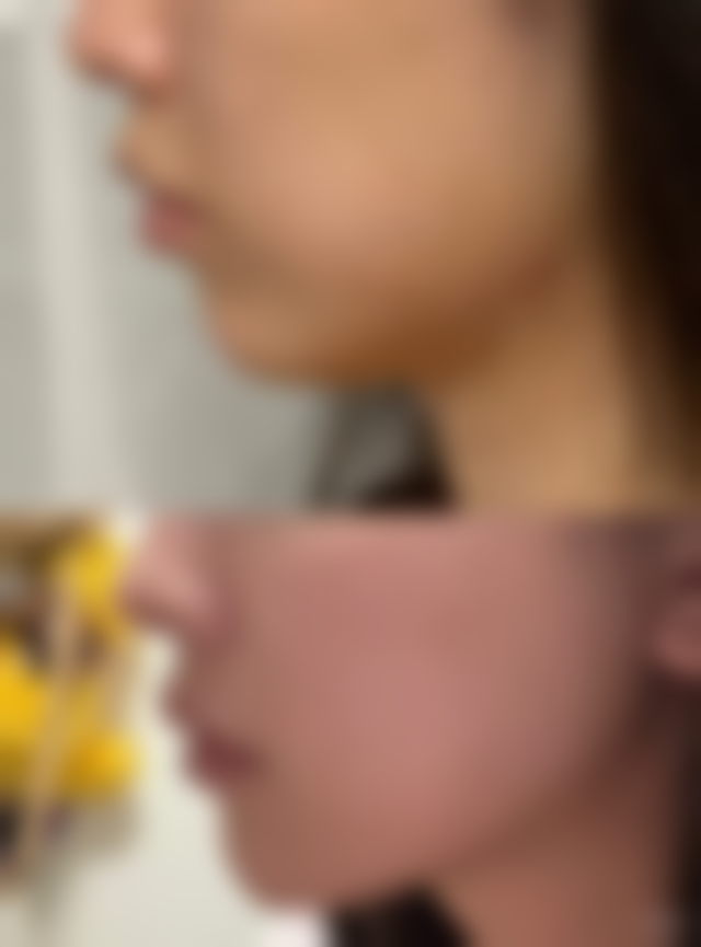 佳木斯美白整形医院地址及乘车路线怎么样