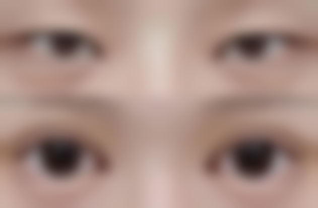 李顺善医生简介做手术价格