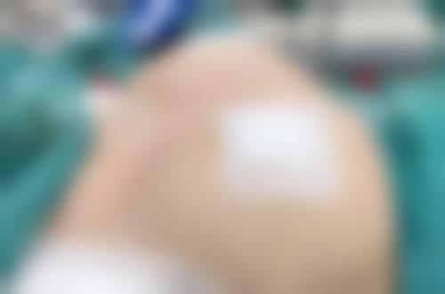 青岛知颜智妍医疗美容门诊部（青岛艾菲）特色项目有哪些