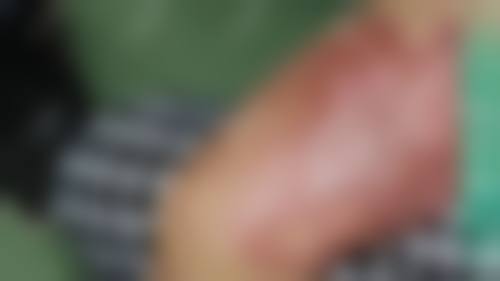 内蒙古华韩医疗美容医院怎么样之真实患者口碑评价